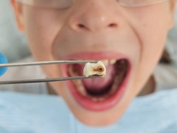 Best Emergency Dental Surgery in Sigourney, IA